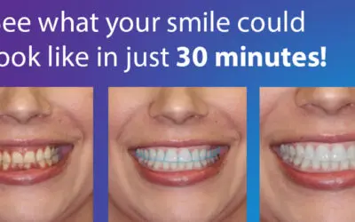 Transform Your Smile with Advanced Design Technology: A Gentle Approach to Your Dream Smile