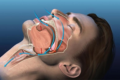 Medical Illustration Snoring Man