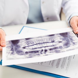 dentist reading mouth x-ray