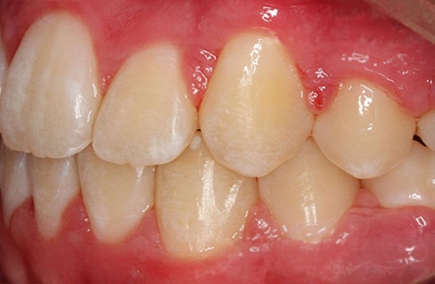 post DeJesus Dental work teeth