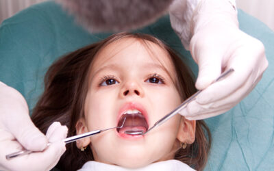 How Often Should Kids See A Dentist?