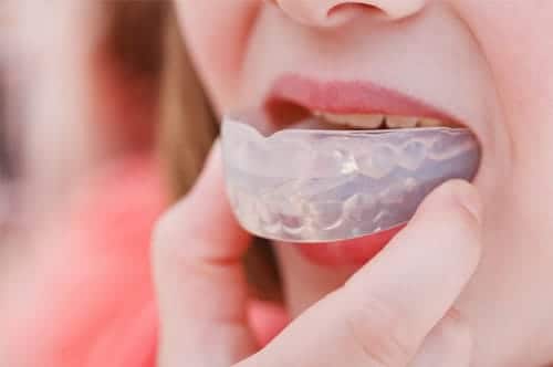 Updated: Keep Your Kids’ Smiles Safe With Athletic Mouthguards