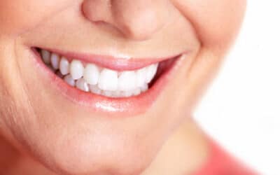 Updated: How Teeth Whitening Gets Rid Of Dark Stains