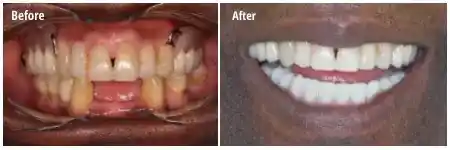 ddg homepage before after 1.jpg opt