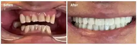 ddg homepage before after 2.jpg opt